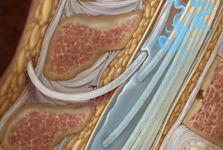 quanto costa motilium compresse buy motilium online