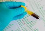 Cognitive Decline in Men Linked to Low Serum Sodium Cognitive Decline in Men Linked to Low Serum Sodium
