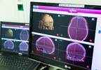 Comparing Reference Points for Deep Brain Stimulation Location in Parkinson Disease Comparing Reference Points for Deep Brain Stimulation Location in Parkinson Disease