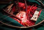 Premature Dementia Risk Increased in Those With Heart Defects Premature Dementia Risk Increased in Those With Heart Defects