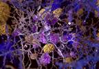 Predicting Progression From Normal Cognition to Mild Cognitive Impairment Predicting Progression From Normal Cognition to Mild Cognitive Impairment