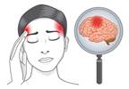 Stroke in Women: Risk, Prevention, and Treatment Stroke in Women: Risk, Prevention, and Treatment