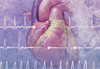 Clarifying Cardiovascular Risk in Migraine Clarifying Cardiovascular Risk in Migraine