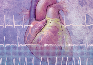 Investigating the Link Between Atrial Fibrillation and Type 2 Diabetes Investigating the Link Between Atrial Fibrillation and Type 2 Diabetes
