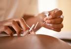 Acupuncture for Pain: Pros and Cons Acupuncture for Pain: Pros and Cons