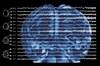 A Convenient Truth: The Problem With Seizure Under-Reporting and How to Fix It A Convenient Truth: The Problem With Seizure Under-Reporting and How to Fix It