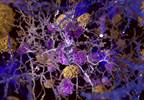 High Amyloid Beta, Independent of Tau, Is Associated With Risk for Cognitive Decline High Amyloid Beta, Independent of Tau, Is Associated With Risk for Cognitive Decline