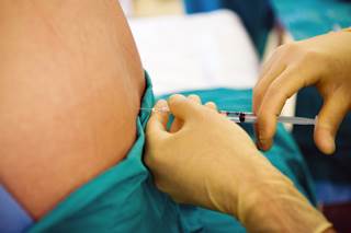 New evidence emphasizes the use of smaller-gauge needles to help prevent postdural puncture headache. New evidence emphasizes the use of smaller-gauge needles to help prevent postdural puncture headache.