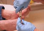 Untrimmed Toenails: A Marker of Functional Status in Older Patients? Untrimmed Toenails: A Marker of Functional Status in Older Patients?
