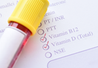 Micronutrient Levels May Be Altered in ADHD Micronutrient Levels May Be Altered in ADHD
