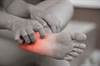 Expert Insight: A Closer Look at Neurological Manifestations of Sjogren Syndrome Expert Insight: A Closer Look at Neurological Manifestations of Sjogren Syndrome