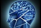 Poststroke Neurocognitive Disorder Prevalent in Acute Stroke Poststroke Neurocognitive Disorder Prevalent in Acute Stroke
