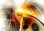 ARISE II Demonstrates Improved Reperfusion With EmboTrap in Ischemic Stroke ARISE II Demonstrates Improved Reperfusion With EmboTrap in Ischemic Stroke