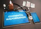 Comparative Risk for Major Congenital Malformations With High-Dose Antiepileptic Drugs Comparative Risk for Major Congenital Malformations With High-Dose Antiepileptic Drugs