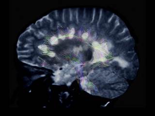 There was an observed association between LV mass index and worse visuospatial memory performance, even after excluding atrial fibrillation, CVD, and LV hypertrophy. There was an observed association between LV mass index and worse visuospatial memory performance, even after excluding atrial fibrillation, CVD, and LV hypertrophy.