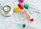 Higher HDL-C Linked to Better Cognition in Older DM Patients Higher HDL-C Linked to Better Cognition in Older DM Patients