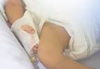Therapeutic Everolimus Monitoring Range Thresholds Established for Tuberous Sclerosis Complex Therapeutic Everolimus Monitoring Range Thresholds Established for Tuberous Sclerosis Complex