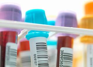 In a study of 933 individuals with a mean age of 78 years, higher serum uromodulin was associated with a lower risk of end-stage renal disease. In a study of 933 individuals with a mean age of 78 years, higher serum uromodulin was associated with a lower risk of end-stage renal disease.