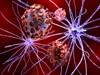 Herpesvirus Abundant in Alzheimer Disease Brain, New Study Finds Herpesvirus Abundant in Alzheimer Disease Brain, New Study Finds