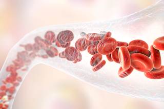 There were no significant differences between individuals on antiplatelet therapy vs individuals on no antithrombotic therapy in terms of thromboembolic events. There were no significant differences between individuals on antiplatelet therapy vs individuals on no antithrombotic therapy in terms of thromboembolic events.