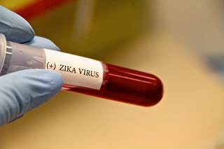 The mosquitoes fed on mice infected with the Zika strains and were later assessed to determine if they could transmit the virus. The mosquitoes fed on mice infected with the Zika strains and were later assessed to determine if they could transmit the virus.