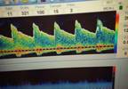 Transcranial Doppler Ultrasound Timing Critical for Beneficial Outcomes Following Stroke Thrombolysis Transcranial Doppler Ultrasound Timing Critical for Beneficial Outcomes Following Stroke Thrombolysis