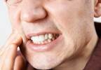 Researchers Identify Demographic, Clinical Variables of Oromandibular Dystonia Researchers Identify Demographic, Clinical Variables of Oromandibular Dystonia