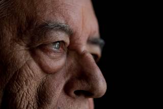 The superior peripapillary retinal nerve fiber layer was significantly thinner in the ipsilateral eye to the most-affected body side of the patients with Parkinson disease. The superior peripapillary retinal nerve fiber layer was significantly thinner in the ipsilateral eye to the most-affected body side of the patients with Parkinson disease.