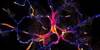 Addressing Levodopa-Resistant Parkinson Disease Addressing Levodopa-Resistant Parkinson Disease