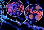 Biomarkers of Alzheimer Disease Observed in Down Syndrome Biomarkers of Alzheimer Disease Observed in Down Syndrome