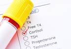 Higher Serum Cortisol Level Linked to Lower Brain Volumes Higher Serum Cortisol Level Linked to Lower Brain Volumes