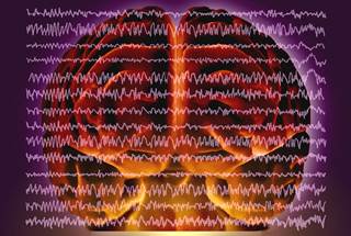 Three groups of investigators (movement disorder experts, epileptologists, and general neurologists) evaluated body sites and movement disorders to detect common features. Three groups of investigators (movement disorder experts, epileptologists, and general neurologists) evaluated body sites and movement disorders to detect common features.