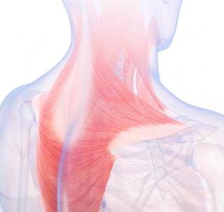The use of trigger point topical treatment with a nonsteroidal anti-inflammatory drug may be as effective as trigger point anesthetic injection to relieve migraine pain. The use of trigger point topical treatment with a nonsteroidal anti-inflammatory drug may be as effective as trigger point anesthetic injection to relieve migraine pain.