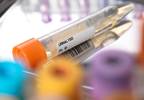 Hospital Infections Increase 30-Day Readmission Rates in Patients With Stroke Hospital Infections Increase 30-Day Readmission Rates in Patients With Stroke
