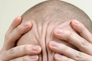 The study included participants diagnosed with migraine by a neurologist specializing in headache. The study included participants diagnosed with migraine by a neurologist specializing in headache.